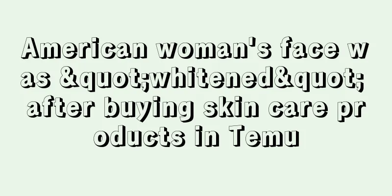 American woman's face was "whitened" after buying skin care products in Temu